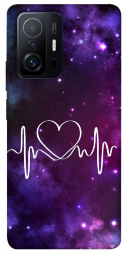 Чехол itsPrint Кардиограмма для Xiaomi 11T / 11T Pro