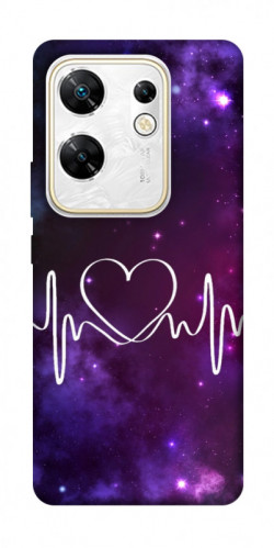 Чехол itsPrint Кардиограмма для Infinix Zero 30 4G