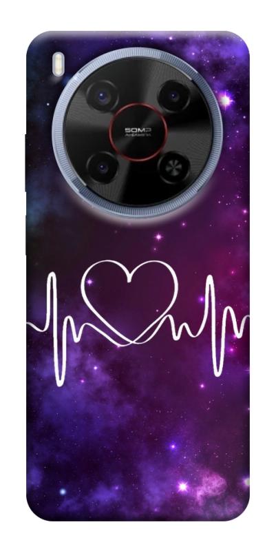 Чехол itsPrint Кардиограмма для ZTE Nubia V70 Max, любовь, купить оптом с доставкой