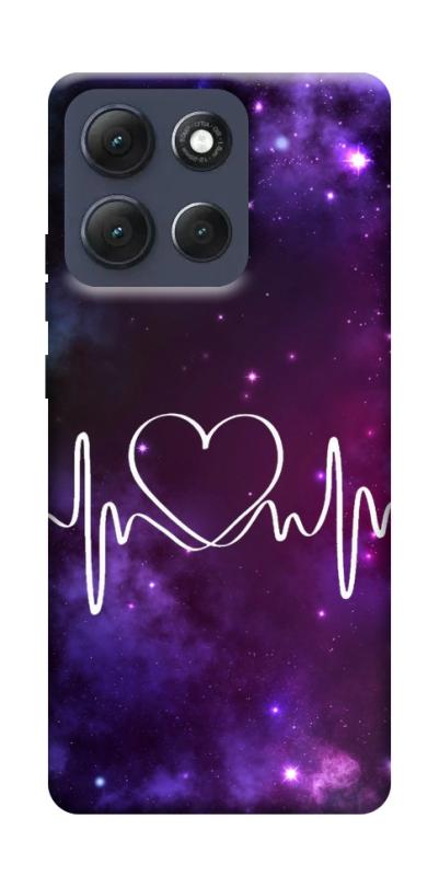 Чехол itsPrint Кардиограмма для Motorola Moto G86 Power, любовь, купить оптом с доставкой