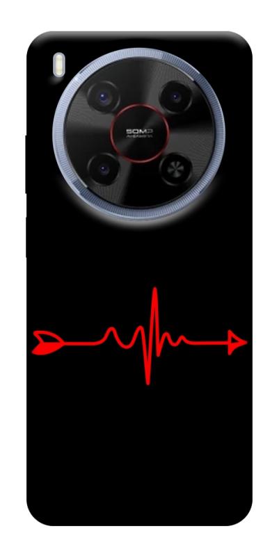 Чехол itsPrint Стрела для ZTE Nubia V70 Max, любовь, купить оптом с доставкой