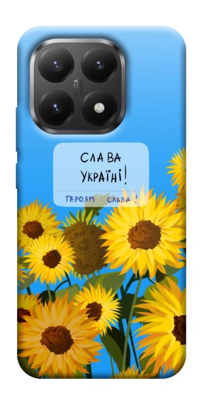 Чехол itsPrint Слава Україні для Xiaomi 15T, love ukraine, купить оптом с доставкой