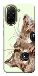 Чехол itsPrint Cat muzzle для Xiaomi Redmi A5 (Europe version)
