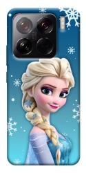 Чехол itsPrint Эльза для Xiaomi 15 Pro