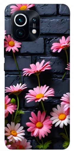 Чехол itsPrint Розовый контраст для Xiaomi Mi 11