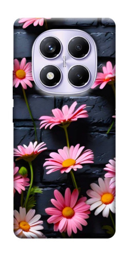 Чехол itsPrint Розовый контраст для Xiaomi Poco X7