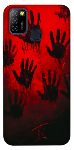 Чехол itsPrint Bloody hands для Infinix Hot 10 Lite