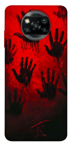 Чехол itsPrint Bloody hands для Xiaomi Poco X3 NFC / Poco X3 Pro
