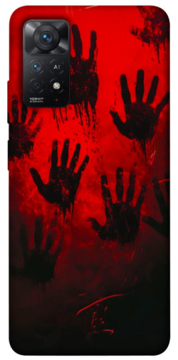 Чехол itsPrint Bloody hands для Xiaomi Redmi Note 11 Pro 4G/5G