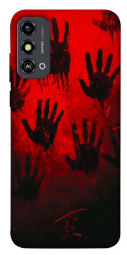 Чехол itsPrint Bloody hands для ZTE Blade A53