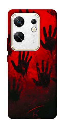 Чехол itsPrint Bloody hands для Infinix Zero 30 4G