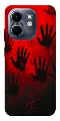 Чехол itsPrint Bloody hands для Infinix Smart 9 4G / Hot 50i