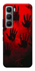 Чехол itsPrint Bloody hands для Infinix Hot 60i
