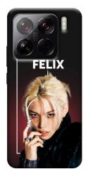Чехол itsPrint Stray kids Felix для Xiaomi 15 Pro