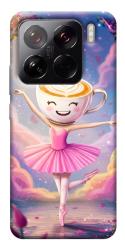Чехол itsPrint Ballerina illustration для Xiaomi 15 Pro