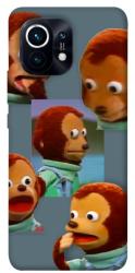 Чехол itsPrint Side eye monkey для Xiaomi Mi 11