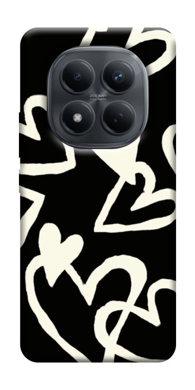 Чехол itsPrint Black and white hearts для Xiaomi Redmi Note 15 Pro 4G, любовь, купить оптом с доставкой