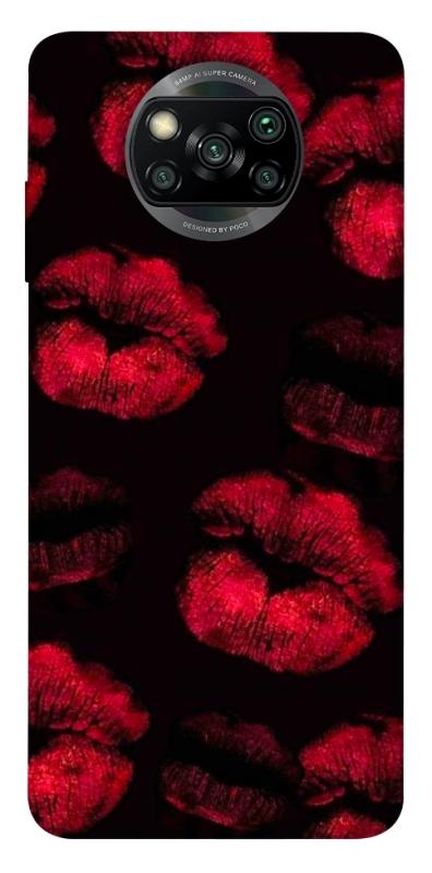 Чехол itsPrint Kisses on black для Xiaomi Poco X3 NFC / Poco X3 Pro, любовь, купить оптом с доставкой