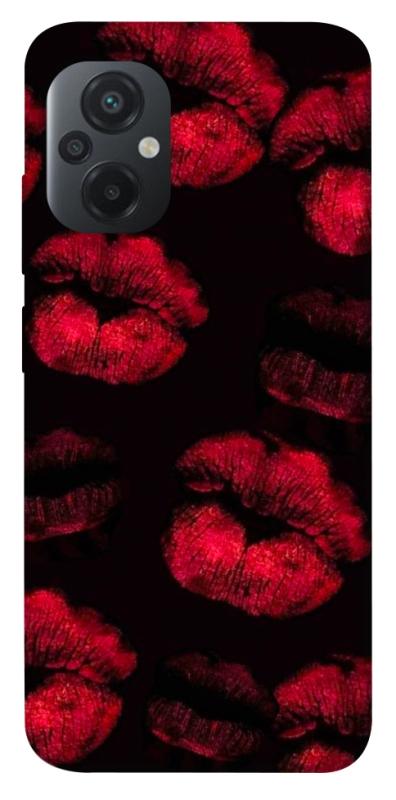 Чехол itsPrint Kisses on black для Xiaomi Poco M5, любовь, купить оптом с доставкой