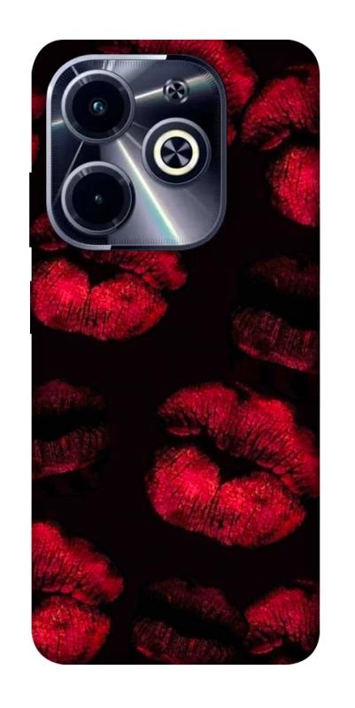 Чехол itsPrint Kisses on black для Infinix Hot 40i, любовь, купить оптом с доставкой