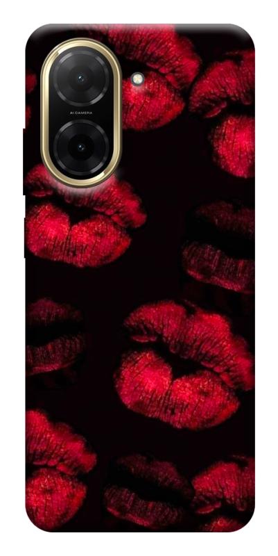 Чехол itsPrint Kisses on black для Xiaomi Redmi A5 (Europe version), любовь, купить оптом с доставкой