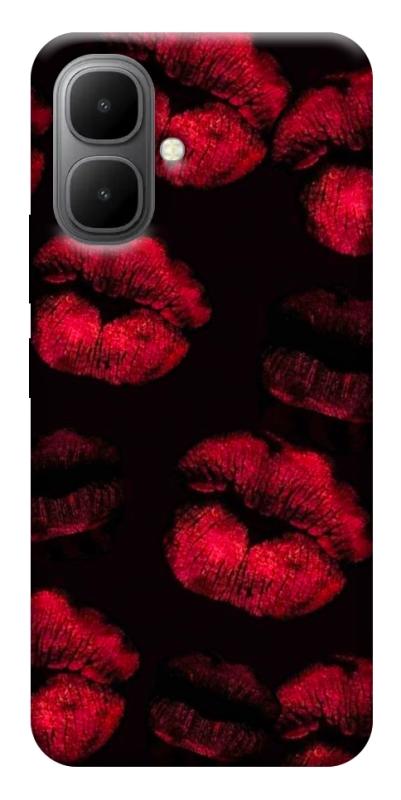 Чехол itsPrint Kisses on black для Infinix Smart 10, любовь, купить оптом с доставкой