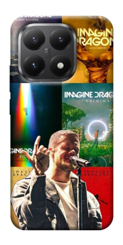 Чехол itsPrint Imagine Dragons для Xiaomi 15T, музыка, купить оптом с доставкой